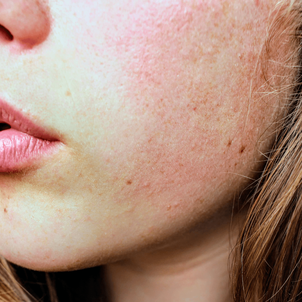 The Dimethicone Deception: Why Many “Clean Skincare” Brands Are Misleading You